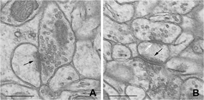 Circadian Changes of Dendritic Spine Geometry in Mouse Barrel Cortex